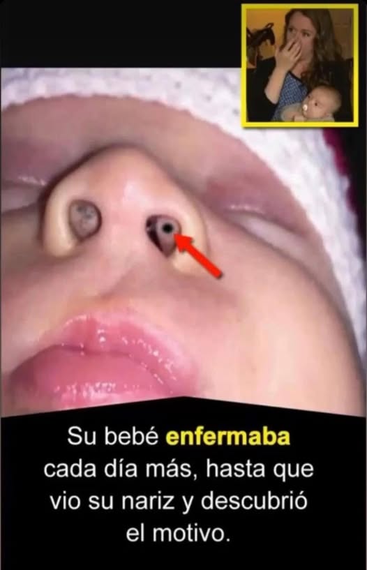 Su bebé se enfermaba cada día más: señales en la nariz que los padres no deben ignorar