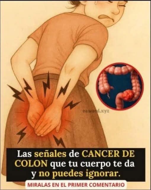 Cáncer de colon: señales de alerta que no debes ignorar y la importancia de un diagnóstico temprano