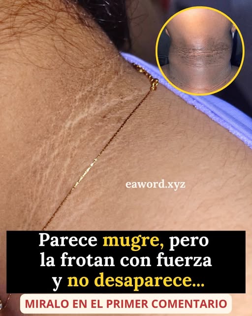 ¿Manchas oscuras en el cuello? No siempre es suciedad: estas podrían ser las causas