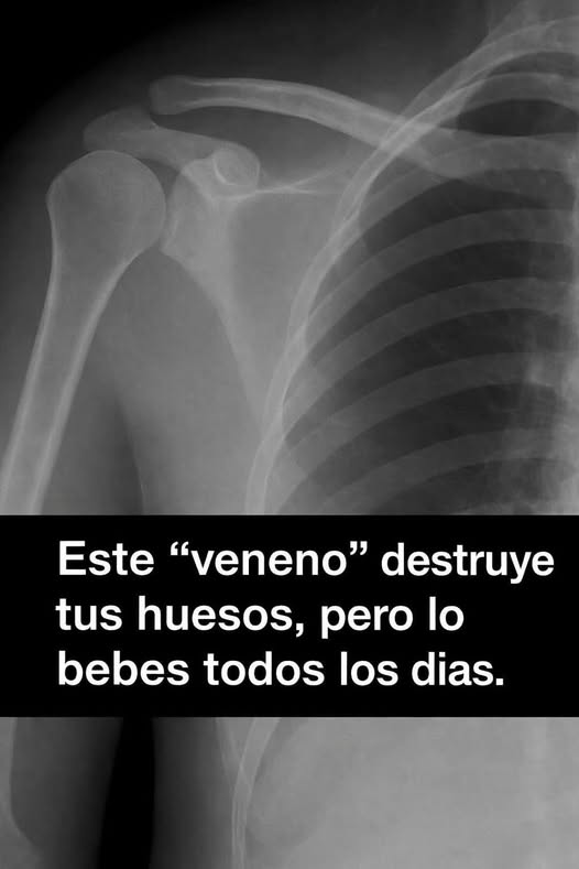 ¿Qué “veneno” puede dañar tus huesos si lo tomas todos los días? Lo que realmente debes saber