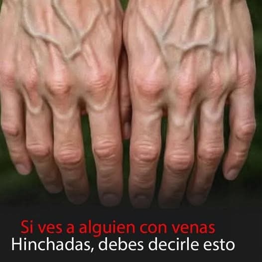 ¿Tienes las venas muy visibles en las manos? Esto es lo que realmente puede significar