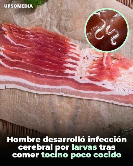 ¿Es peligroso comer tocino poco cocido? Lo que debes saber sobre las infecciones por parásitos