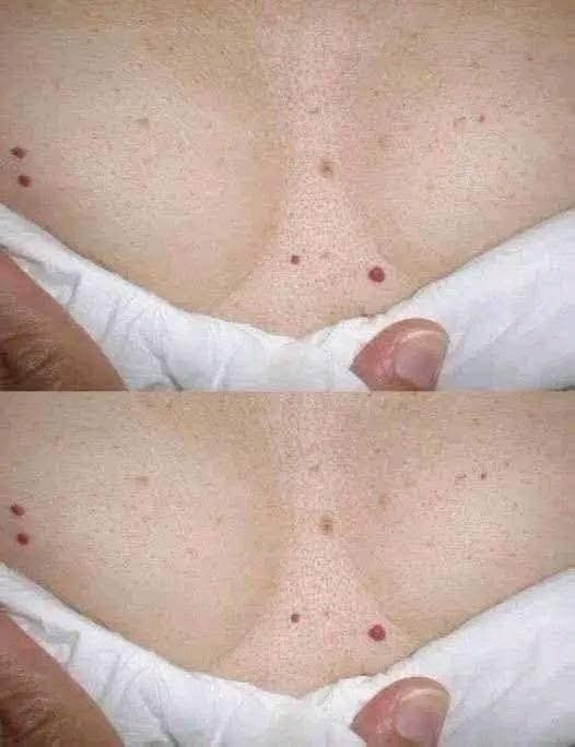 🔴 ¿Tienes pequeños puntos rojos en la piel? Esto es lo que realmente podrían significar