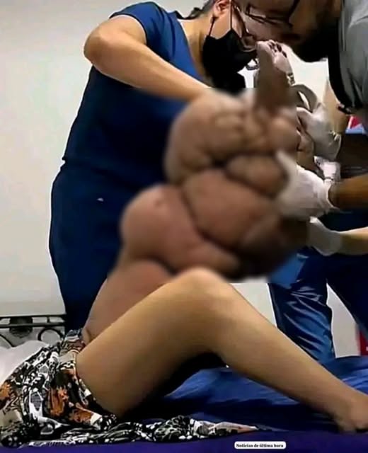 ¿Dormir con una mano bajo el cuerpo puede provocar graves deformaciones? La verdad detrás de la imagen viral