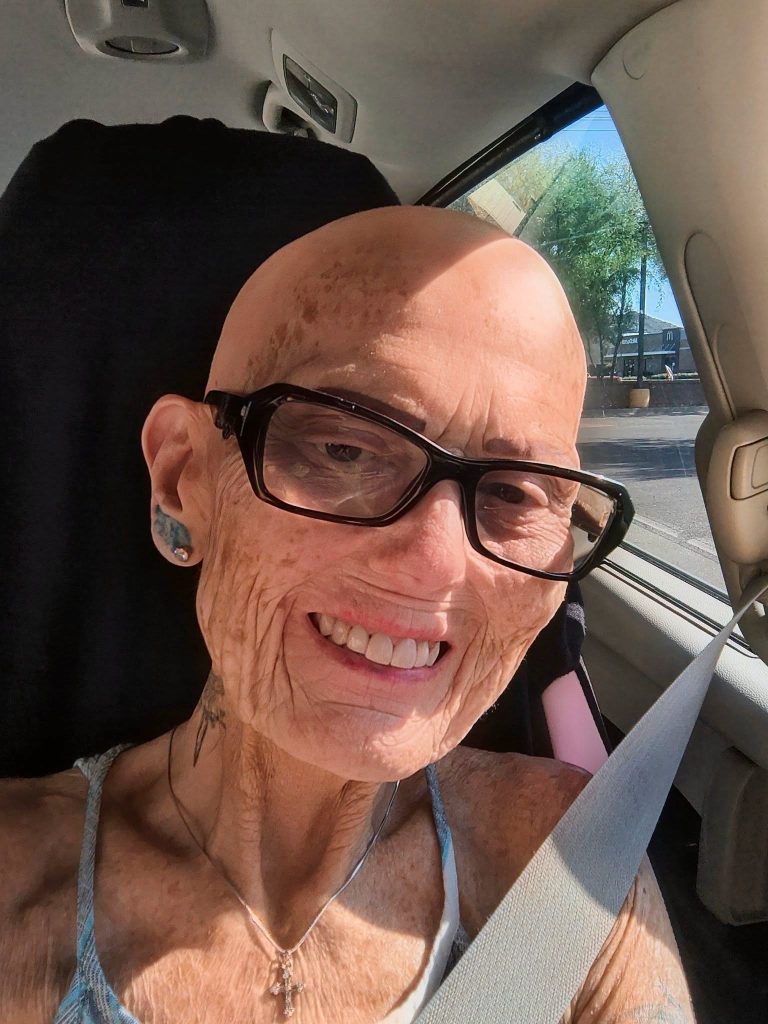 La historia de Billie: una mujer que enfrenta un agresivo cáncer con una sonrisa que inspira a miles