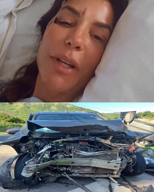 ¿Una famosa cantante sufrió un grave accidente? La verdad detrás de la imagen viral que conmociona las redes
