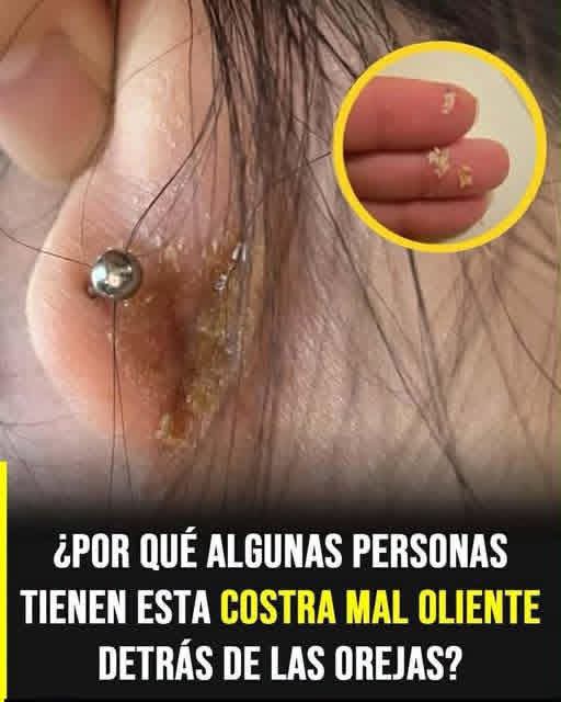 Costras detrás de las orejas: causas, tratamiento y cuándo debes preocuparte