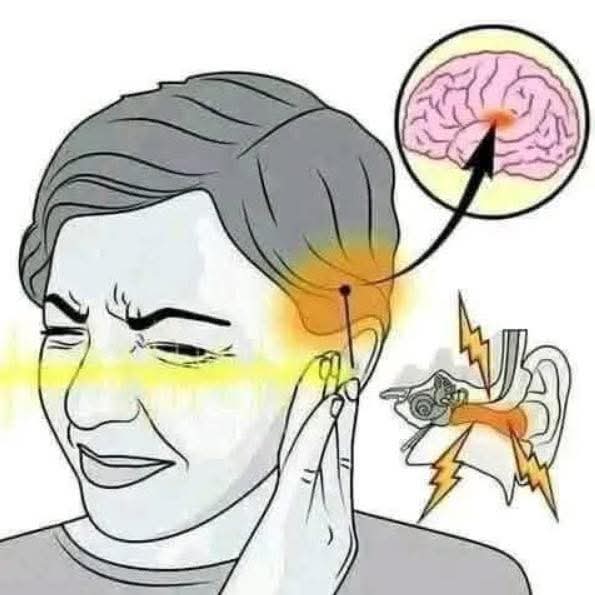 Zumbidos en el oído (tinnitus): causas, síntomas y cuándo es importante consultar al médico