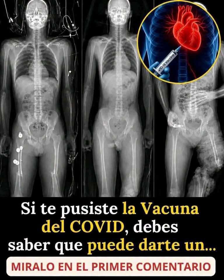 Vacunas contra la COVID-19: efectos secundarios conocidos y cuándo es importante consultar al médico