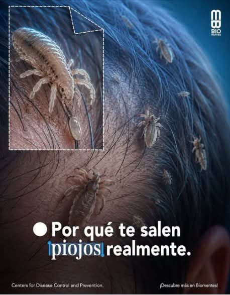 ¿Por qué aparecen los piojos? Mitos y verdades sobre su contagio