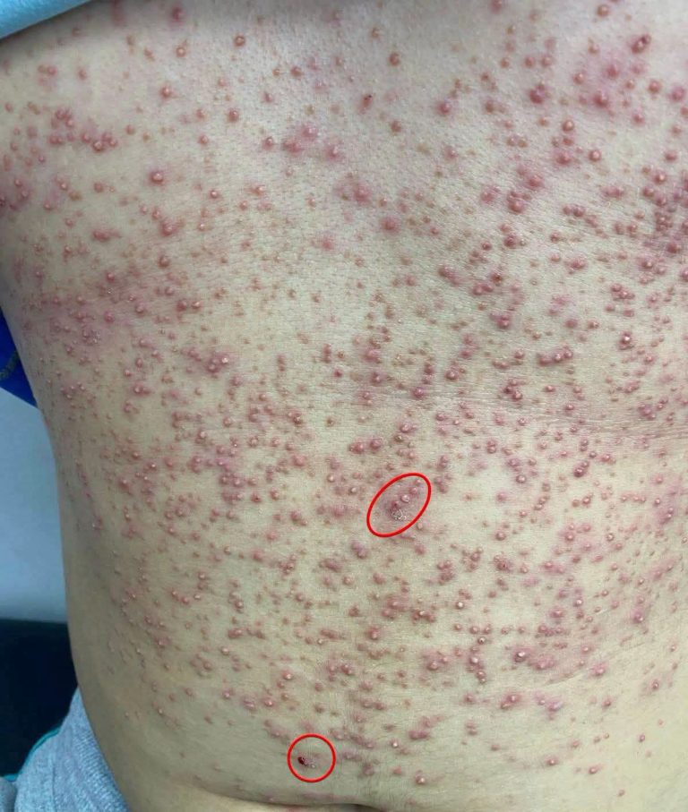 Erupciones en la piel: estas son las posibles causas y cuándo debes acudir al médico