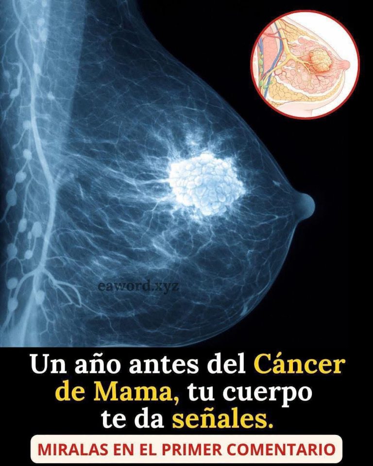 Estos son los signos tempranos del cáncer de mama que no debes ignorar: lo que realmente dice la medicina