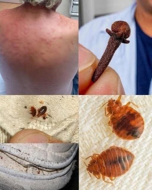 No dejes que los ácaros y chinches invadan tu cama: cómo identificarlos, prevenirlos y eliminarlos de forma segura
