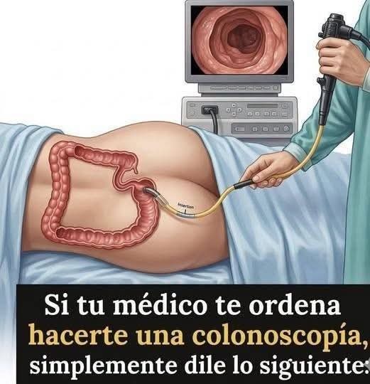 La advertencia sobre la colonoscopia que se hizo viral: esto es lo que realmente debes saber antes del examen