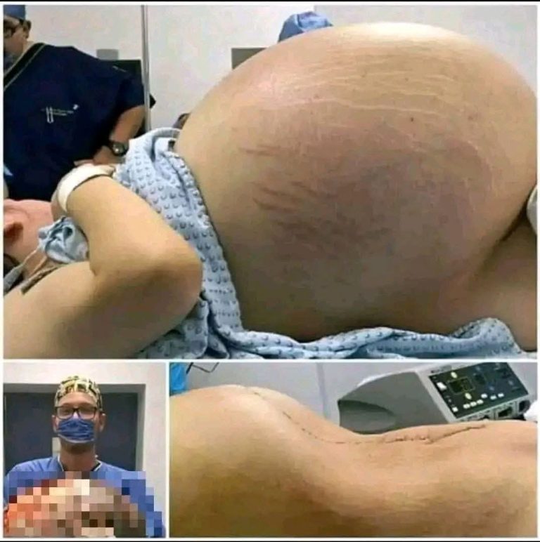 ¿Fue al hospital para dar a luz y los médicos encontraron otra cosa? La verdad detrás de la impactante imagen viral