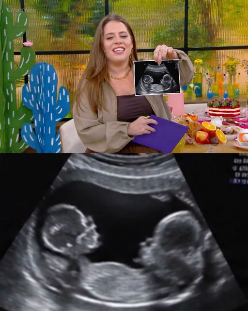 Tati Machado anuncia que será madre y emociona a miles con la feliz noticia de su embarazo