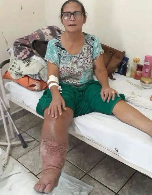 Estas son las posibles consecuencias de dormir con medias demasiado apretadas durante toda la noche