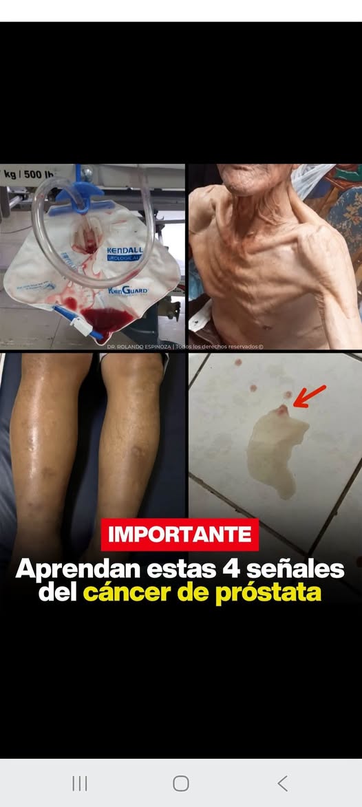 4 señales relacionadas con la próstata que ningún hombre debería ignorar, aunque no siempre significan cáncer