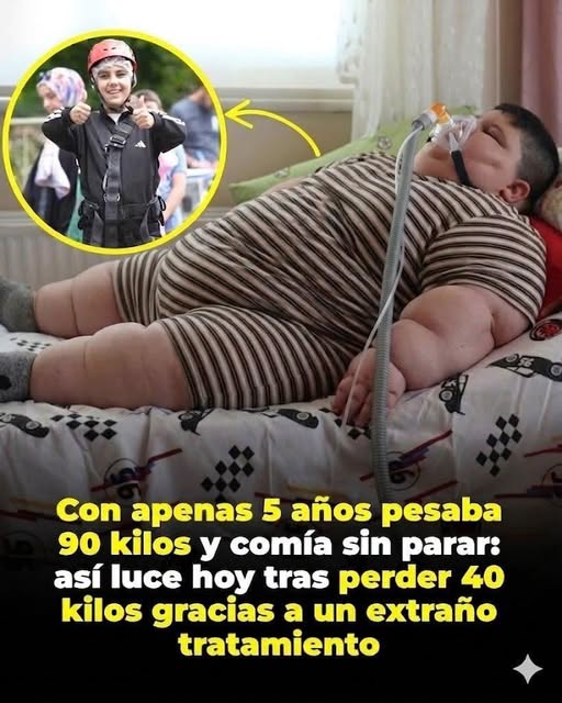 El sorprendente cambio de un niño que enfrentó obesidad severa desde muy temprana edad