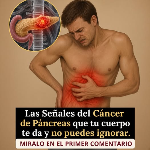 Señales del cáncer de páncreas que pueden pasar desapercibidas