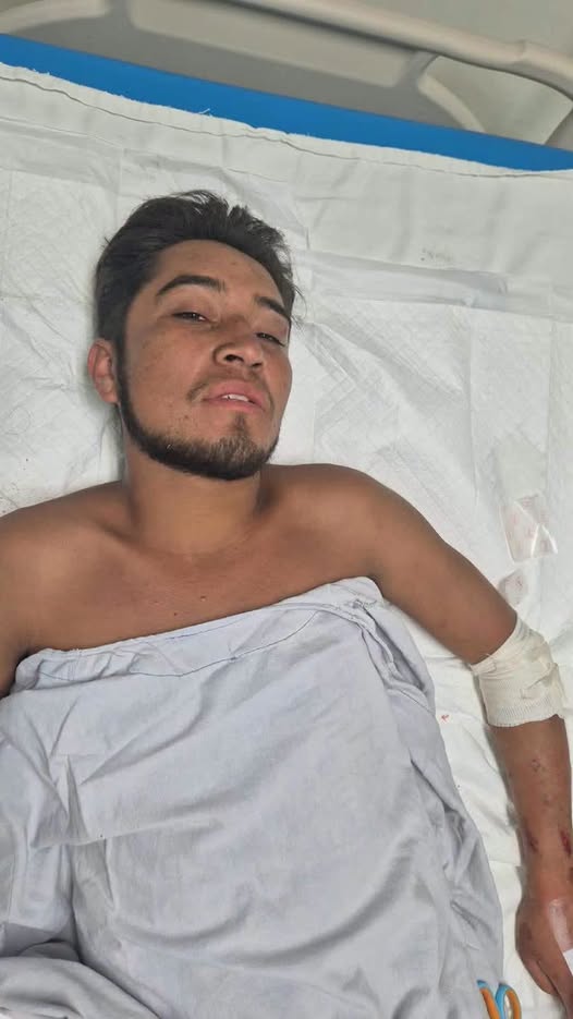 Joven resulta lesionado en Huatulco y permanece bajo atención médica