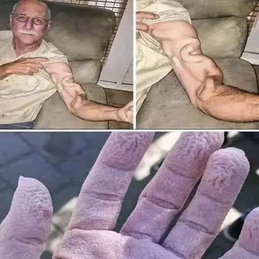 ¿Por qué pueden sobresalir las venas de los brazos? Estas son las posibles causas y señales de alerta
