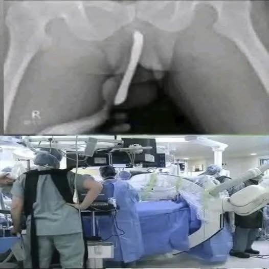 Joven termina hospitalizada por una emergencia inesperada que requirió intervención médica