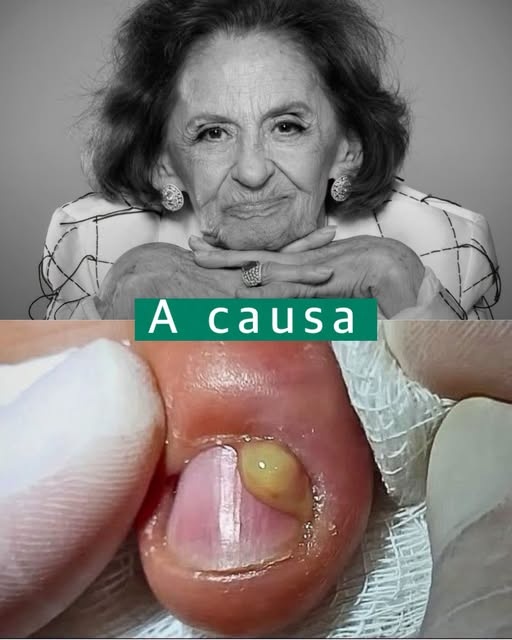 Laura Cardoso: preocupación en redes tras una publicación viral que relaciona su imagen con una infección