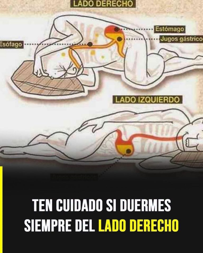 SI DUERMES SIEMPRE DEL LADO DERECHO, ESTO ES LO QUE PUEDE OCURRIR CON EL REFLUJO DURANTE LA NOCHE