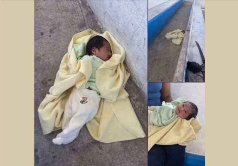 LA VERDAD SOBRE EL BEBÉ CON LABIO LEPORINO QUE FUE ABANDONADO Y VOLVIÓ A HACERSE VIRAL