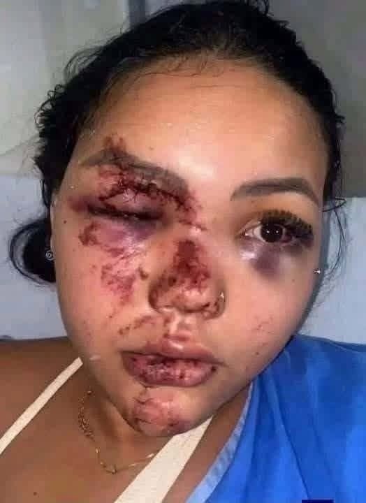 FOTO DE UNA MUJER LESIONADA SE HACE VIRAL JUNTO A UNA HISTORIA DE SUPUESTA INFIDELIDAD