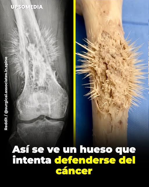Patrones óseos llamativos en radiografías: qué pueden indicar y por qué necesitan evaluación especializada