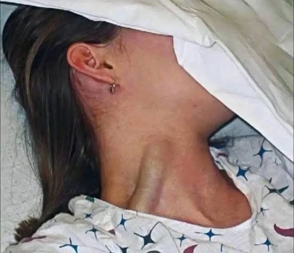 Cambio visible en el cuello al despertar: causas comunes y cuándo conviene revisarlo